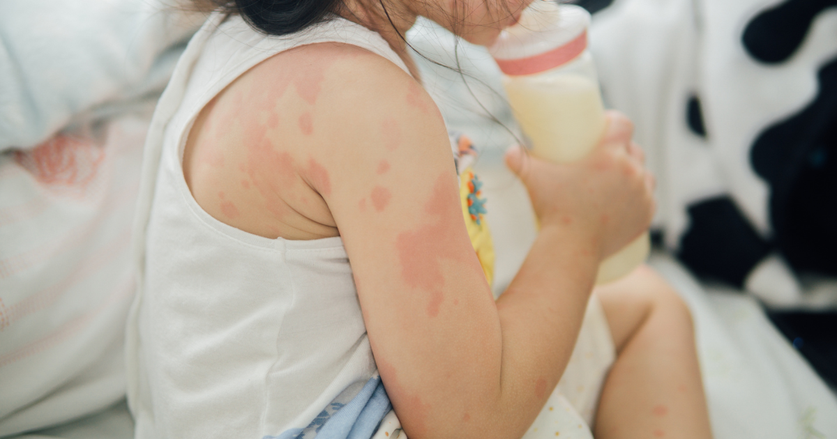 頭暈、疲勞、鼻子過敏？這些都是濕氣重症狀的求救訊號！